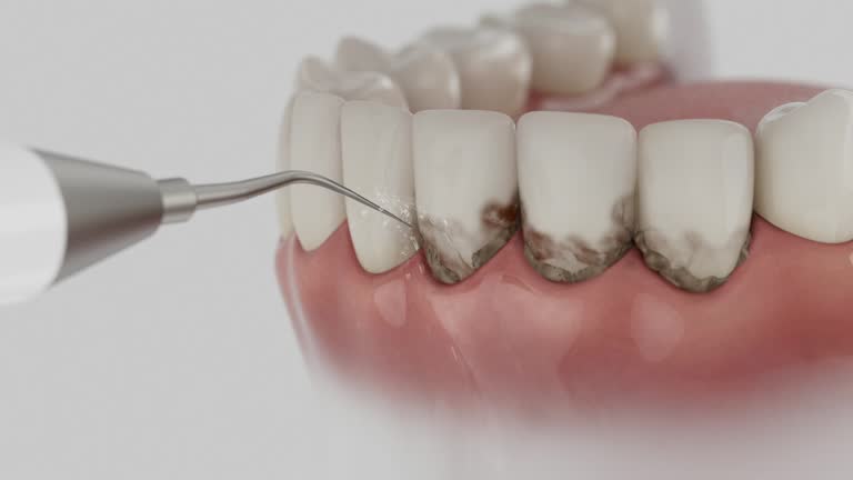 Reliable Dental contractor in New Pekin, IN by Dentist Open Now